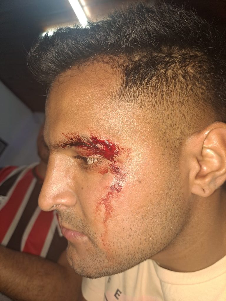 Tres policías lesionados al intentar detener a un sujeto tras un robo