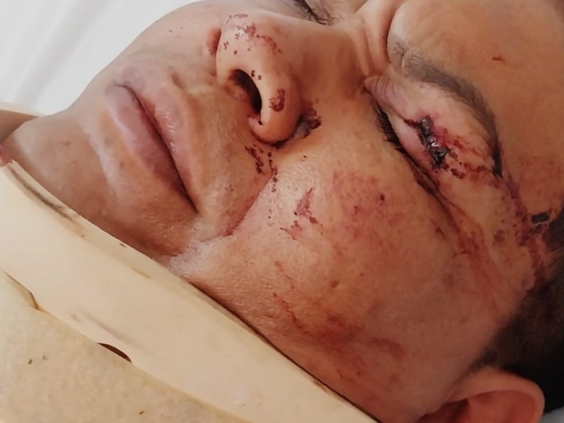 Policía terminó en terapia tras ser atropellado por “wileros” en pleno centro de Sáenz Peña Policía terminó en terapia tras ser atropellado por “wileros” en pleno centro de Sáenz Peña
