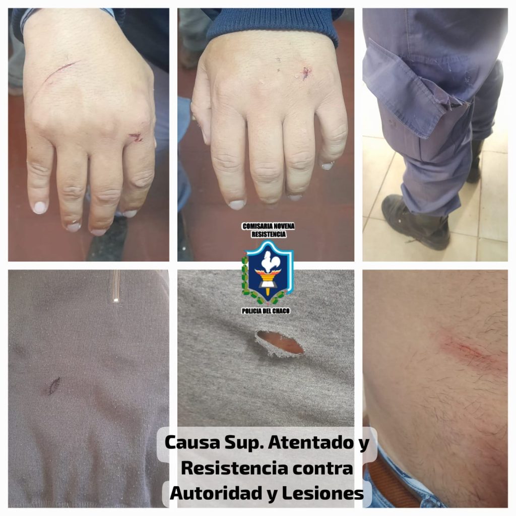 Intentó evadir a la policía, hirió a dos agentes y terminó detenido Intentó evadir a la policía, hirió a dos agentes y terminó detenido