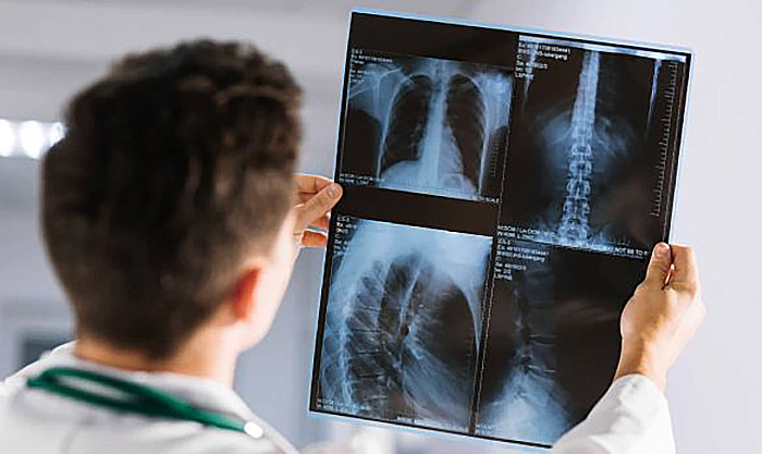 8 de noviembre: Día Mundial de la Radiología 8 de noviembre: Día Mundial de la Radiología
