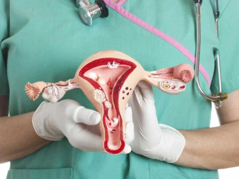 Alertan sobre la demora en el diagnóstico y tratamiento del cáncer de ovario Alertan sobre la demora en el diagnóstico y tratamiento del cáncer de ovario